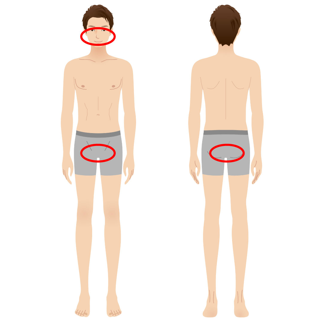 尻 ヘルペス お ヘルペスの治療は内科でもできる？具体的な治療法も確認