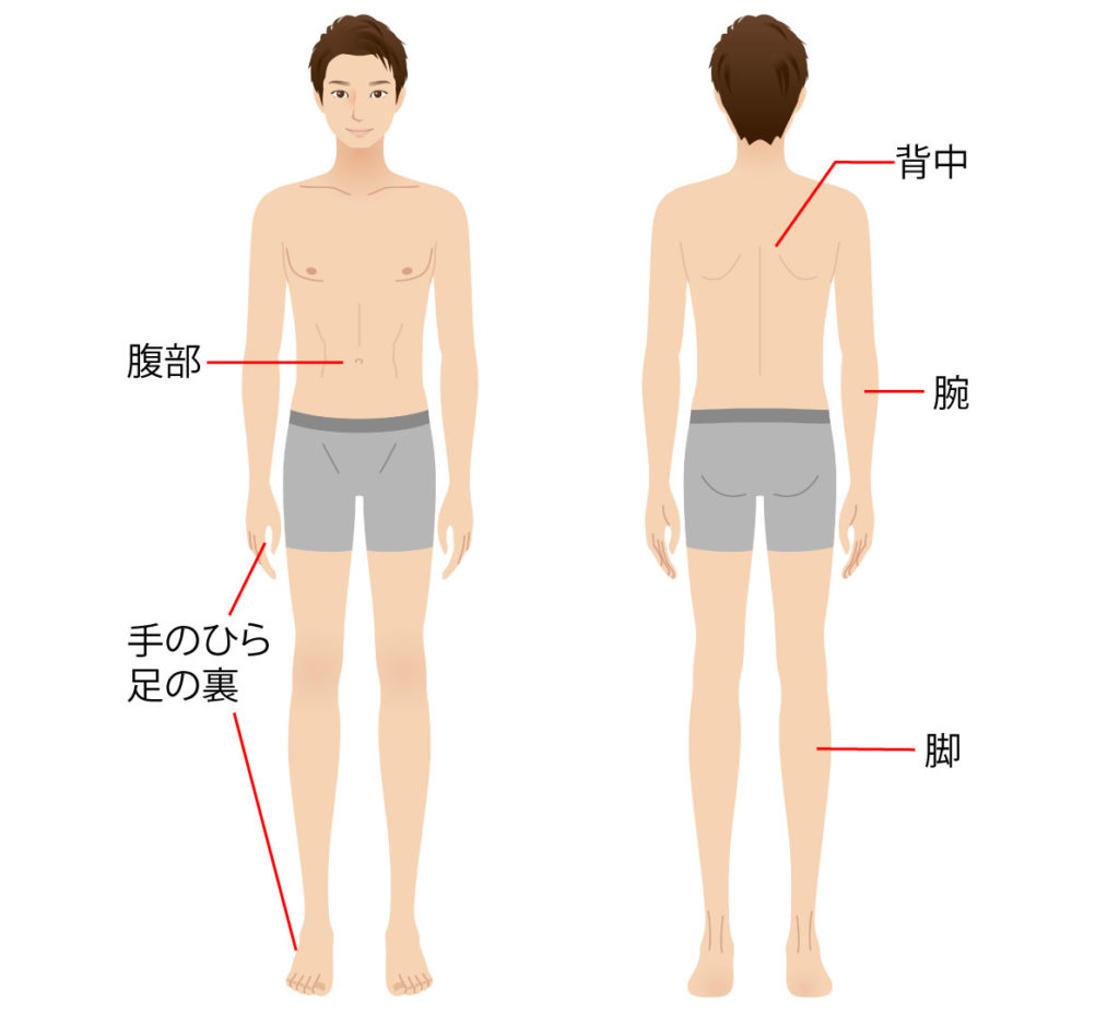 梅毒 について 正しい の は どれ か