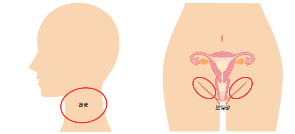 斑点 亀頭 赤い 亀頭に赤い点：それらは何ですか？ 原因、他の症状と治療