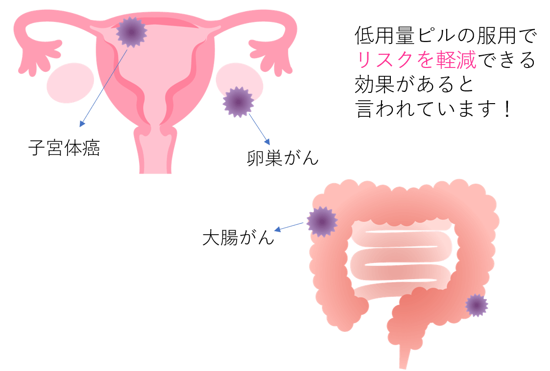 低用量ピル