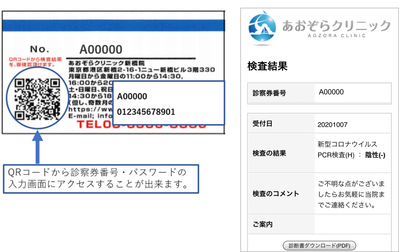 検査 結果 日数 コロナ MIT Tech