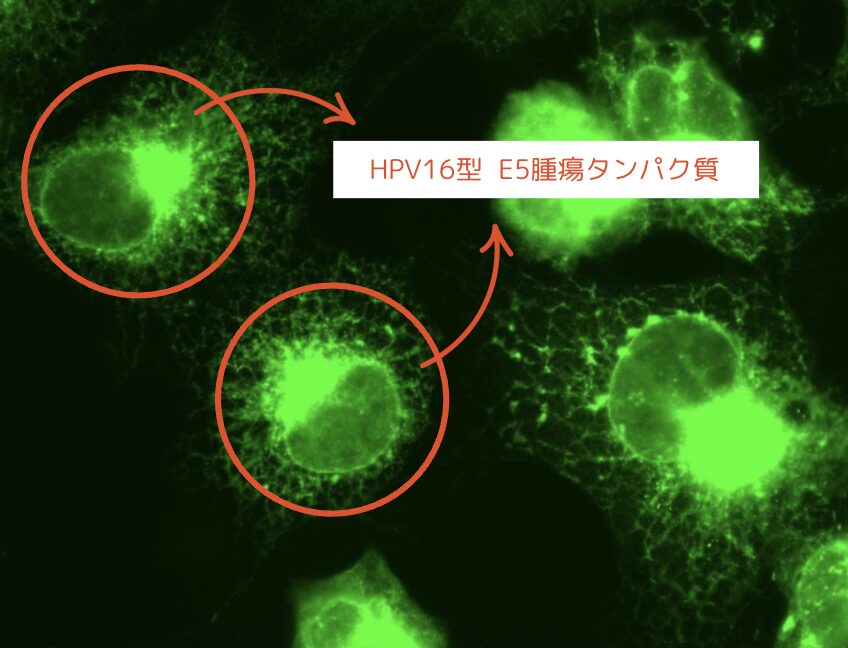 HPV!&