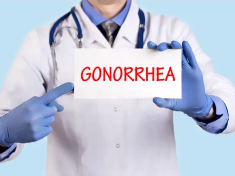 淋病 症例