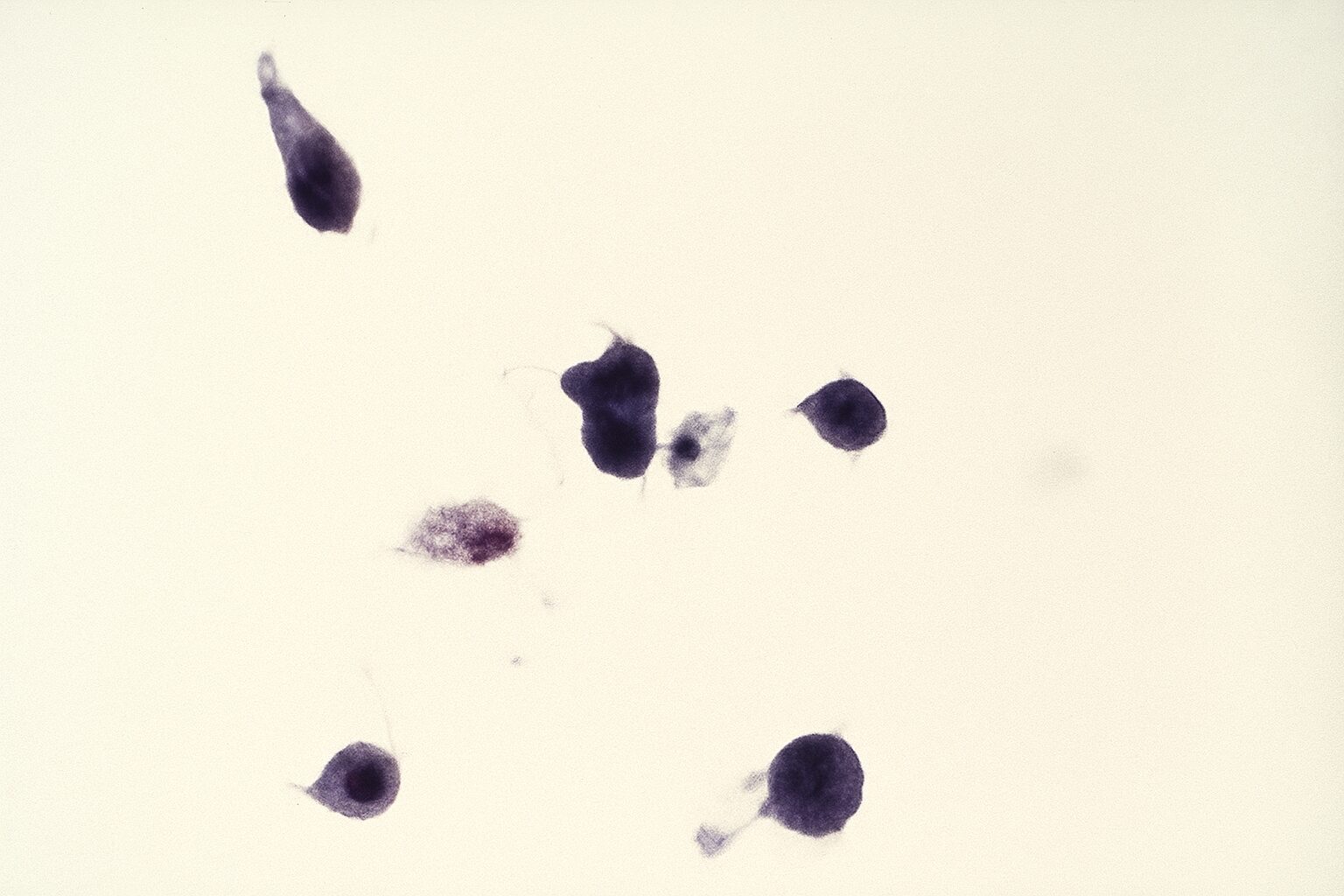 トリコモナス寄生虫画像