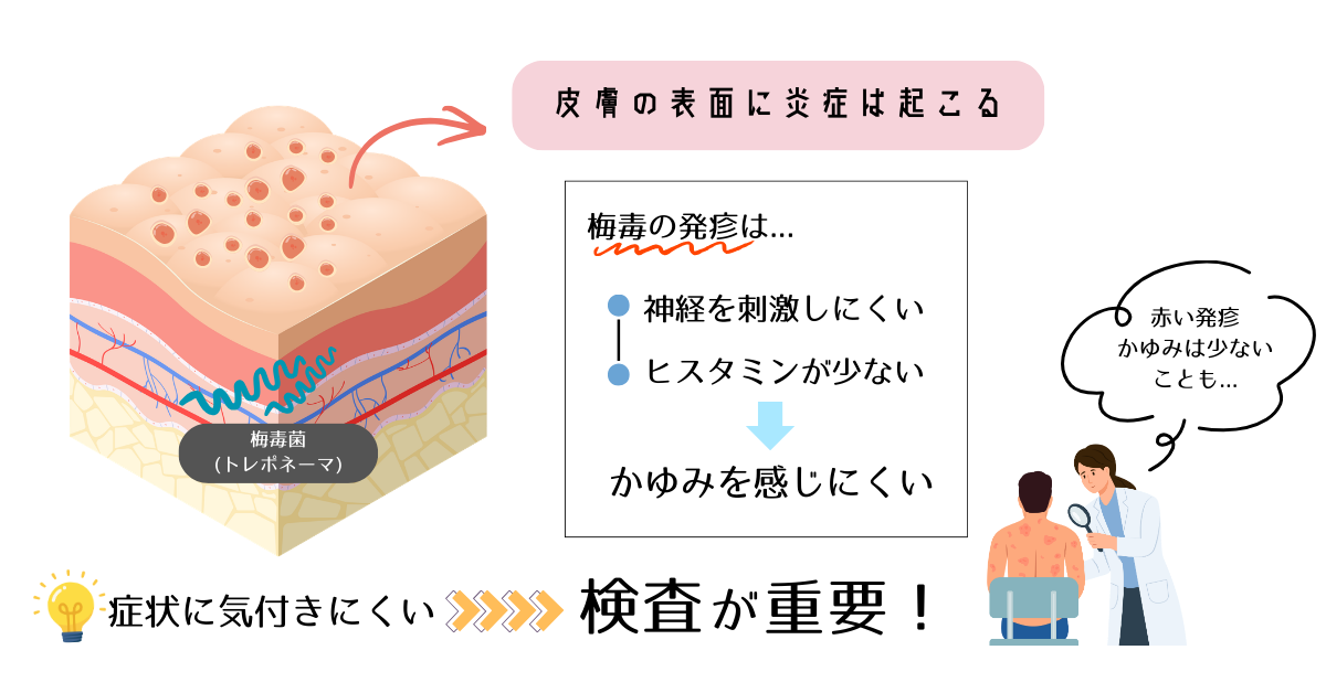 梅毒の発疹でかゆみが弱い理由を説明する皮膚断面の模式図