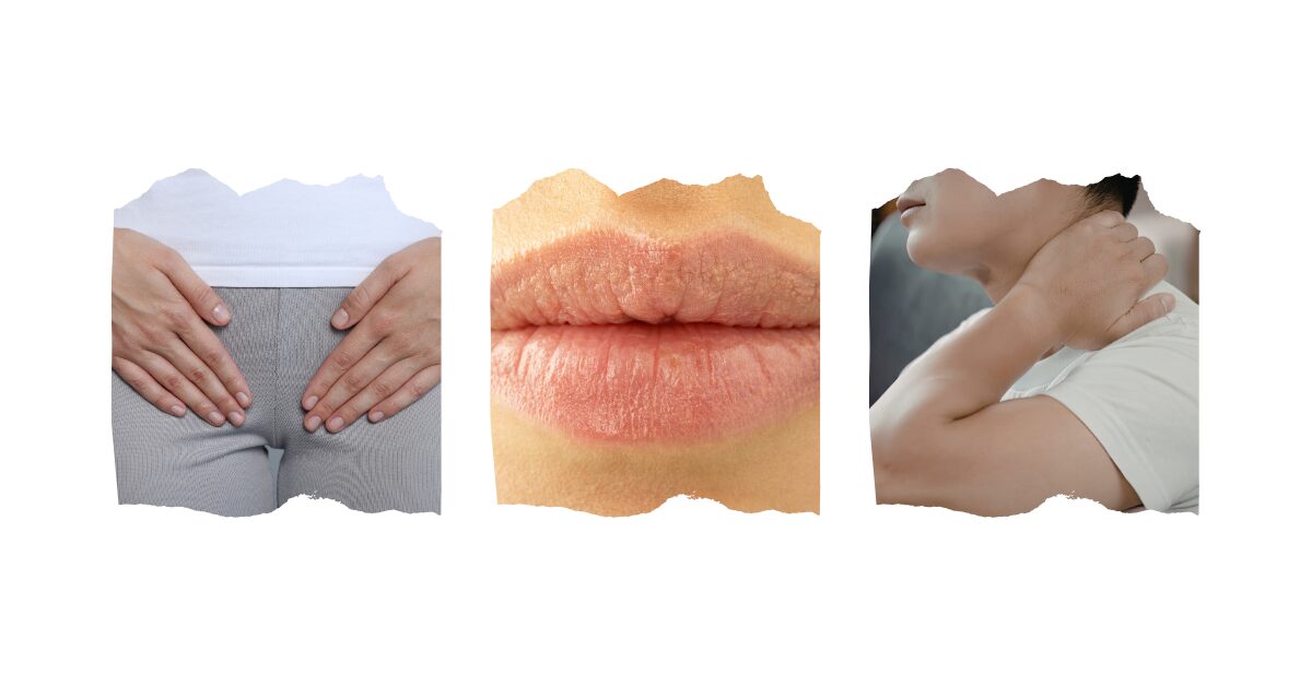 梅毒で痛みが出る部位を示した画像