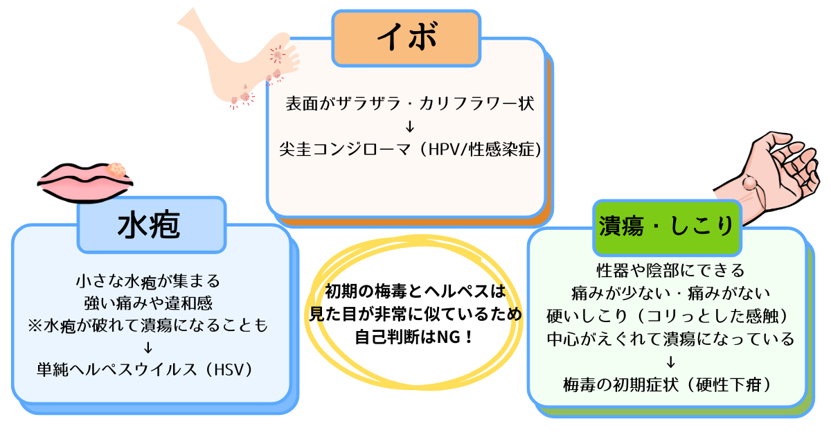 イボ・水疱・潰瘍・しこりの違いについての説明