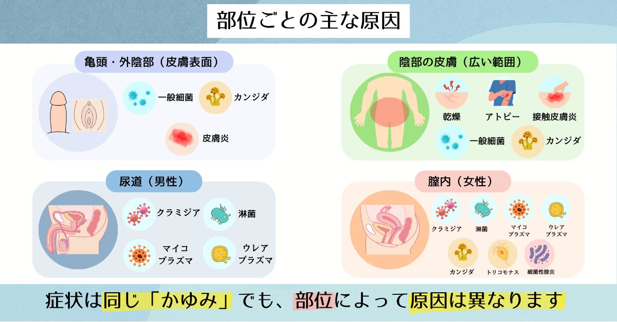 陰部 かゆみ 部位別 原因 図