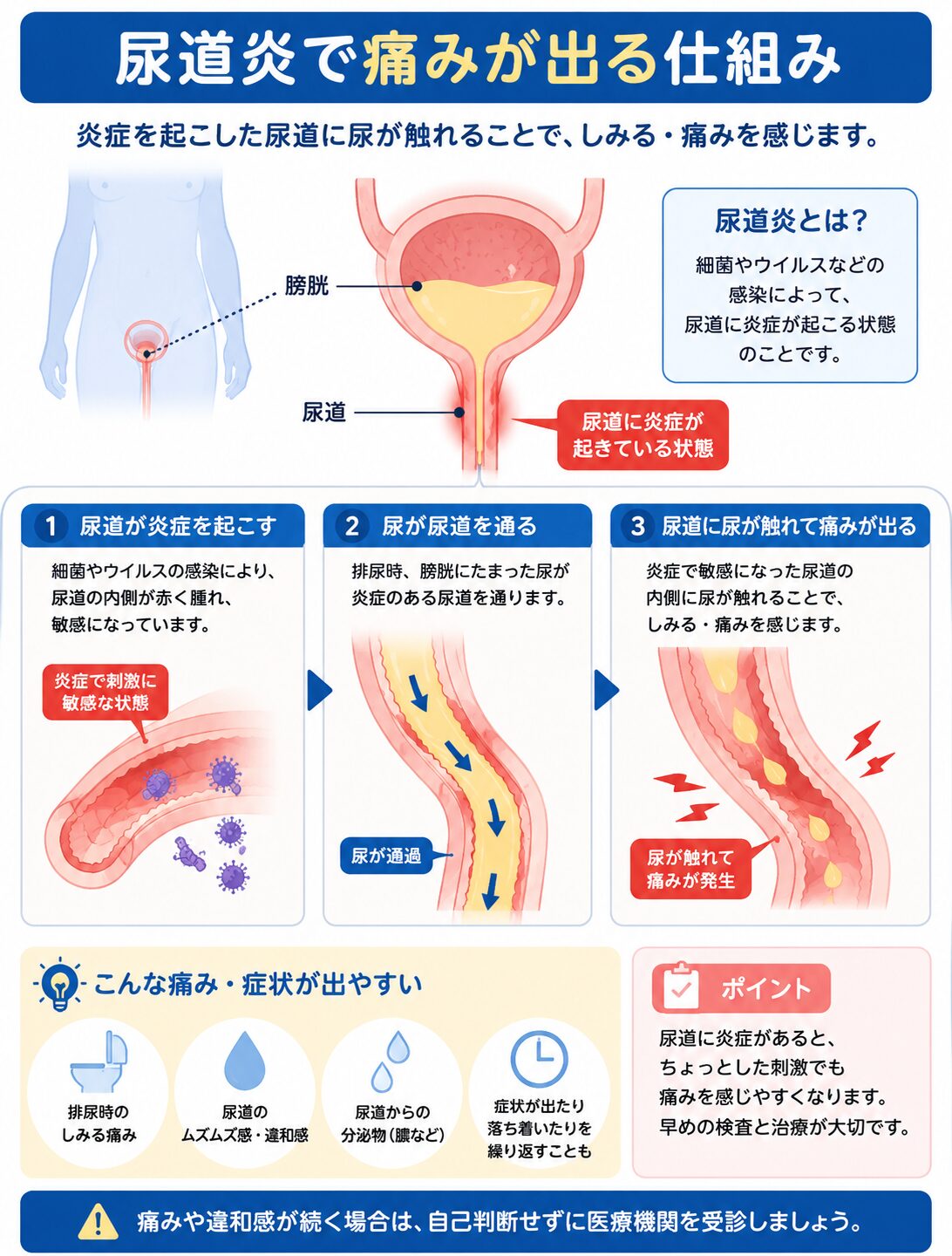 尿道炎で排尿時に痛みが出る仕組み
