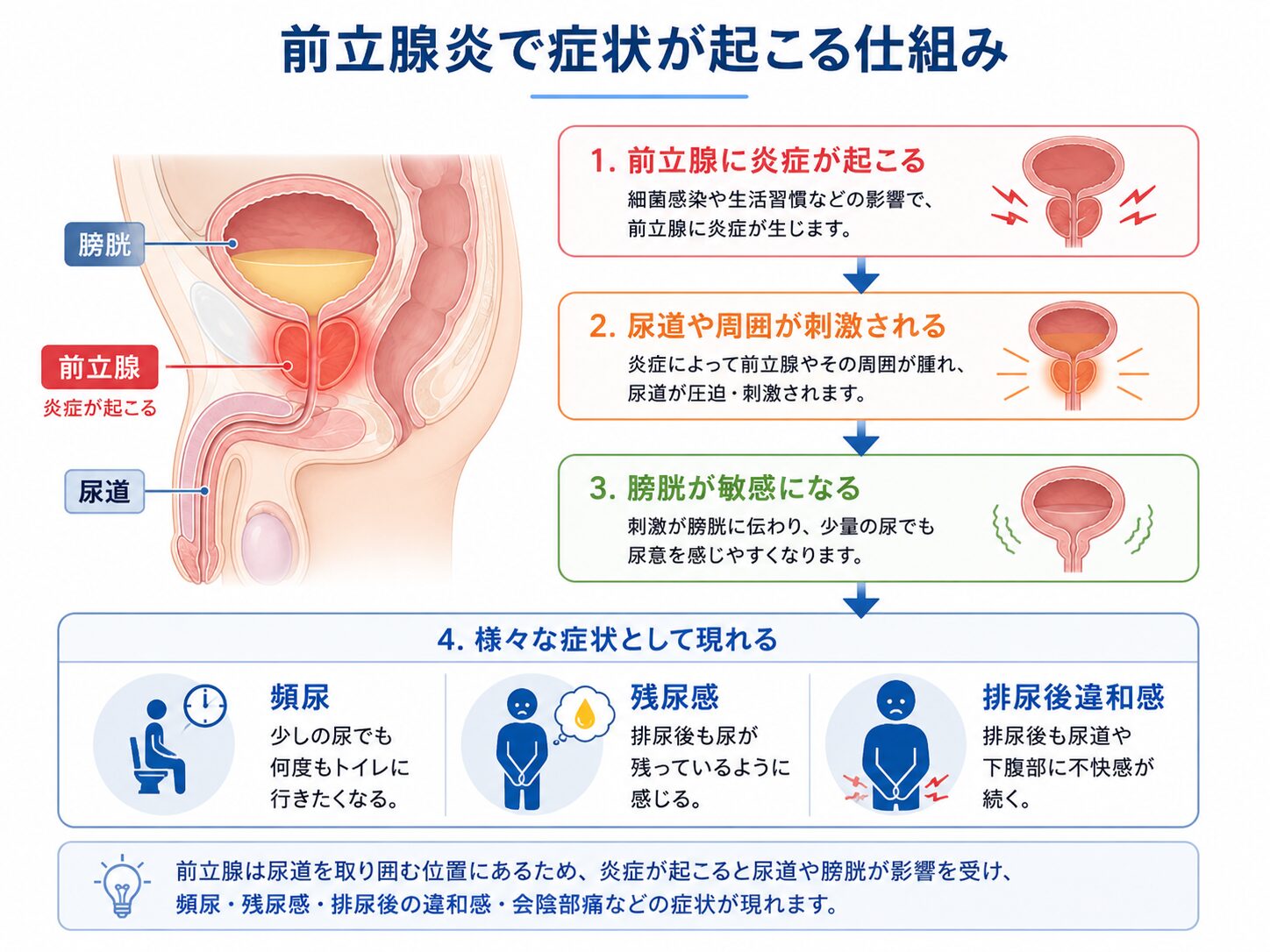 前立腺炎で症状が起こる仕組み