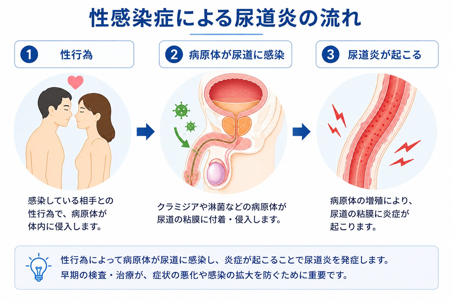 性感染症による尿道炎の流れ